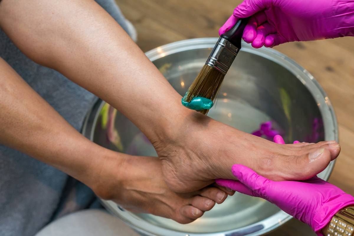 Moisturizing Cream for Foot Corn: 7 Proven Tips to Avoid Painful Mistakes